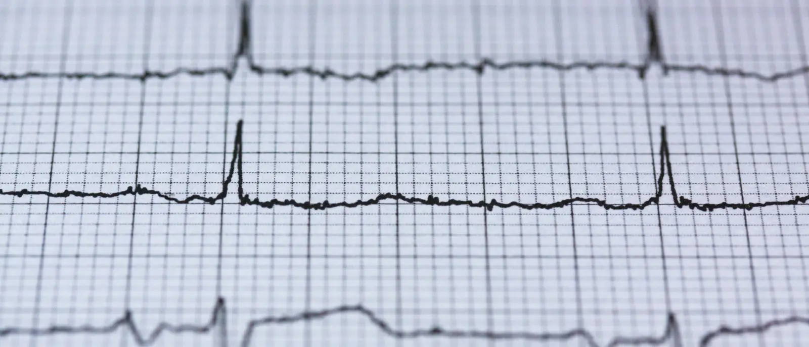 Entrevista com Javier González, engenheiro de materiais e fundador da The Open Ventilator